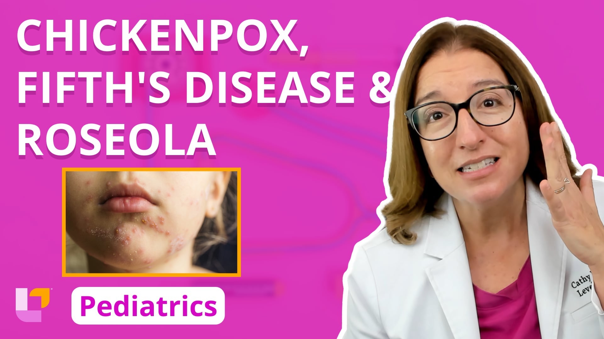 Immune Disorders - Chickenpox, Fifth's Disease, & Roseola