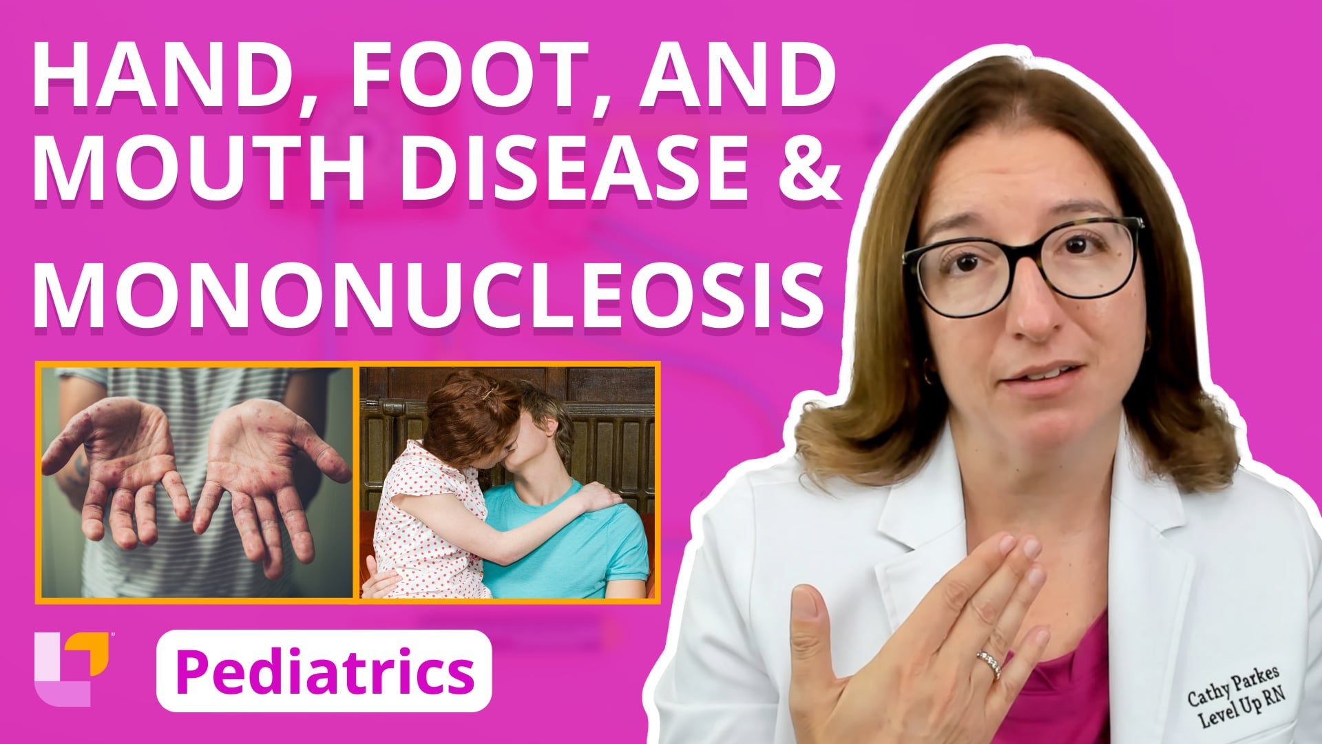 Pediatrics, part 78: Immune Disorders - Hand, Foot, and Mouth Disease ...