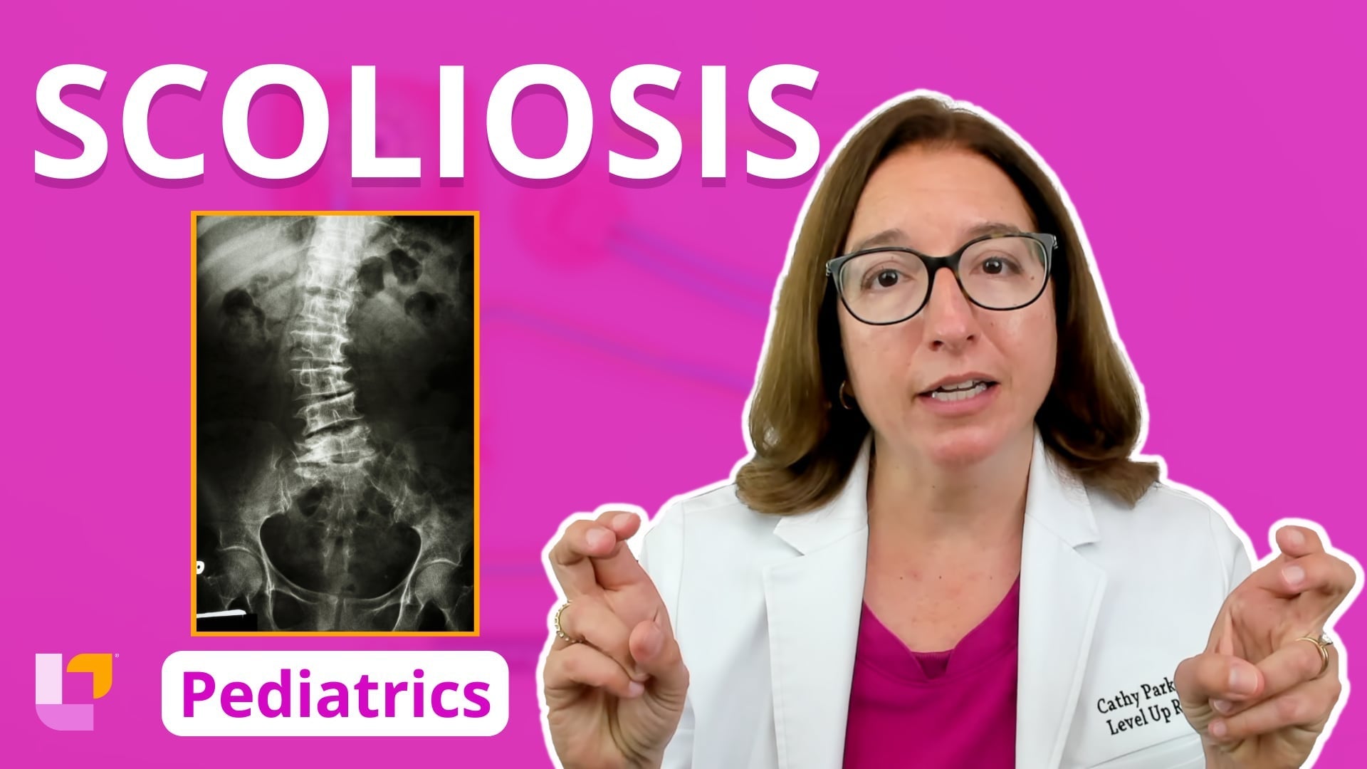 Peds, part 41: Musculoskeletal Disorders - Scoliosis – LevelUpRN