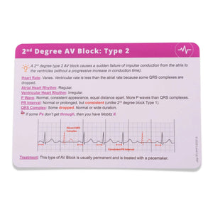 EKG Interpretation - Nursing Flashcards - LevelUpRN